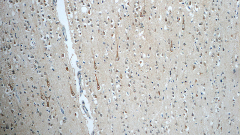 Immunohistochemistry of paraffin-embedded human brain tissue slide using Catalog No:115504(SORCS1 Antibody) at dilution of 1:50 (under 10x lens)