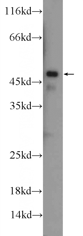mouse heart tissue were subjected to SDS PAGE followed by western blot with Catalog No:111753(ILK Antibody) at dilution of 1:1000