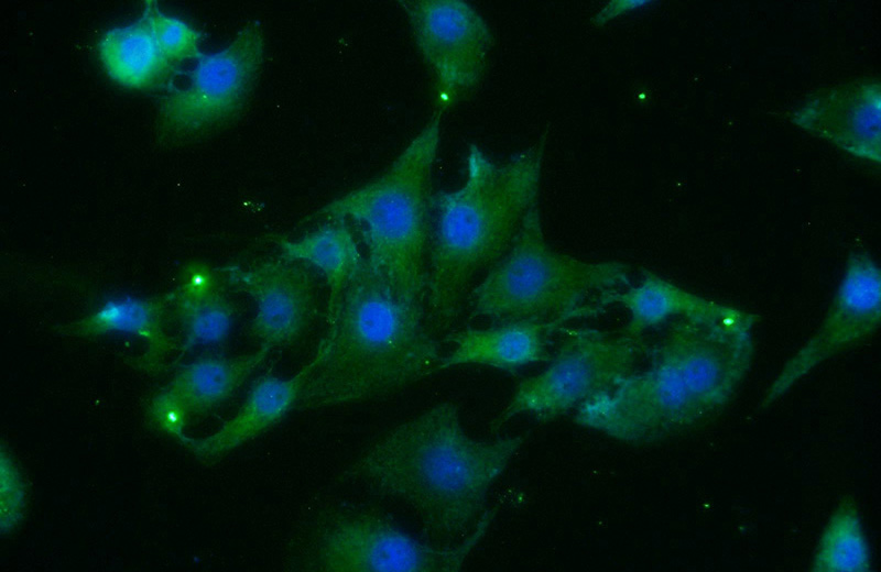 Immunofluorescent analysis of SH-SY5Y cells using Catalog No:108414(BAIAP3 Antibody) at dilution of 1:25 and Alexa Fluor 488-congugated AffiniPure Goat Anti-Rabbit IgG(H+L)