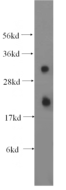 HeLa cells were subjected to SDS PAGE followed by western blot with Catalog No:109243(CEACAM21 antibody) at dilution of 1:500