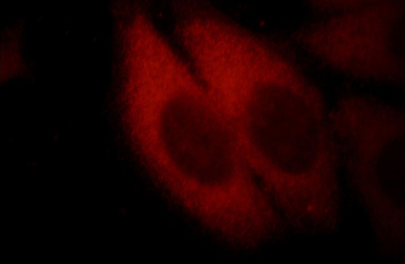 Immunofluorescent analysis of HepG2 cells, using EXOSC2 antibody Catalog No: at 1:25 dilution and Rhodamine-labeled goat anti-mouse IgG (red).