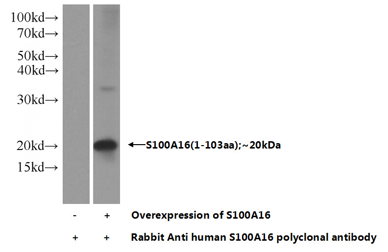 Transfected HEK-293 cells were subjected to SDS PAGE followed by western blot with Catalog No:114959(S100A16 Antibody) at dilution of 1:1000