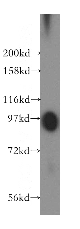 human blood tissue were subjected to SDS PAGE followed by western blot with Catalog No:113942(PLG antibody) at dilution of 1:400