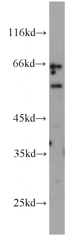 mouse liver tissue were subjected to SDS PAGE followed by western blot with Catalog No:112268(LAG3 antibody) at dilution of 1:500