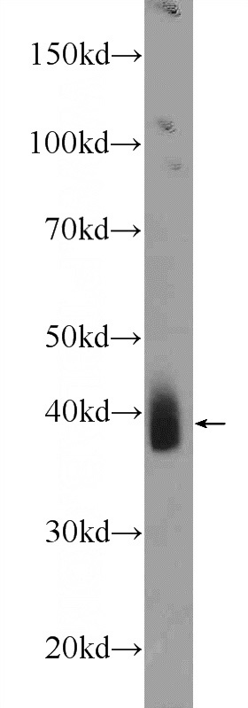 mouse skeletal muscle tissue were subjected to SDS PAGE followed by western blot with Catalog No:113237(NKX3-2 Antibody) at dilution of 1:300