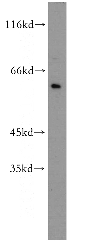HeLa cells were subjected to SDS PAGE followed by western blot with Catalog No:113304(NOP56 antibody) at dilution of 1:500