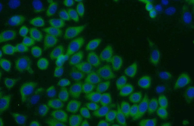 Immunofluorescent analysis of MCF-7 cells using Catalog No:113246(NME1 Antibody) at dilution of 1:50 and Alexa Fluor 488-congugated AffiniPure Goat Anti-Rabbit IgG(H+L)