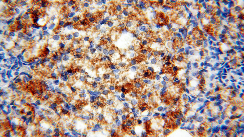 Immunohistochemical of paraffin-embedded human ovary using Catalog No:115735(STRAP antibody) at dilution of 1:100 (under 40x lens)