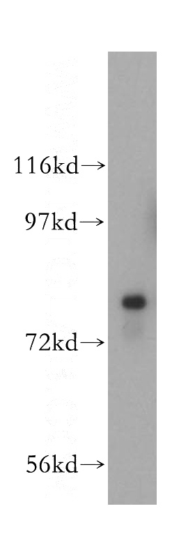 mouse brain tissue were subjected to SDS PAGE followed by western blot with Catalog No:111547(HSD17B4 antibody) at dilution of 1:400