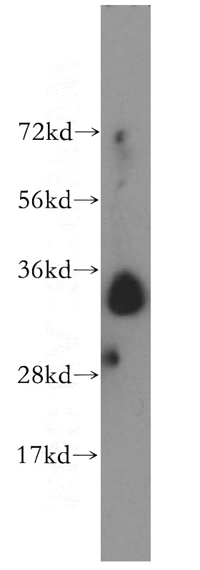 human brain tissue were subjected to SDS PAGE followed by western blot with Catalog No:115675(STC2 antibody) at dilution of 1:500