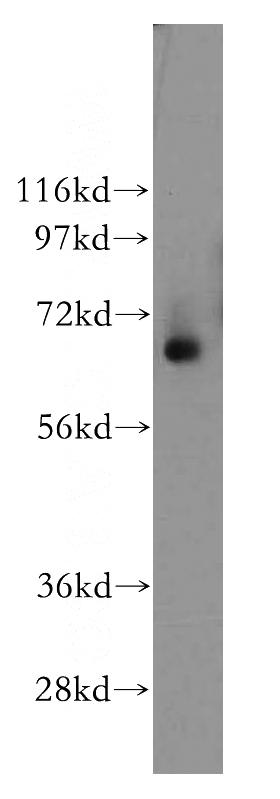 human colon tissue were subjected to SDS PAGE followed by western blot with Catalog No:116209(TPP1 antibody) at dilution of 1:300