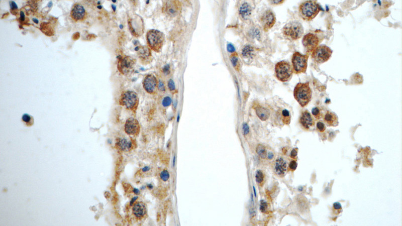 Immunohistochemistry of paraffin-embedded human testis tissue slide using Catalog No:113841(PIWIL1 Antibody) at dilution of 1:50 (under 40x lens)
