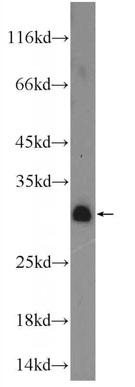 MDA-MB-453s cells were subjected to SDS PAGE followed by western blot with Catalog No:110543(FBXL15 Antibody) at dilution of 1:300