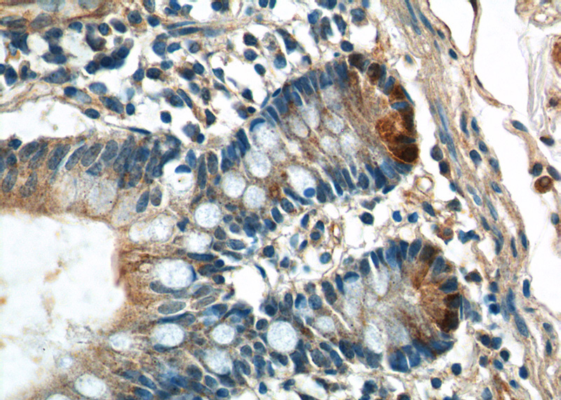 Immunohistochemistry of paraffin-embedded human small intestine tissue slide using Catalog No:112414(Lysozyme Antibody) at dilution of 1:200 (under 40x lens)