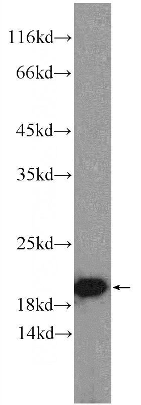 HeLa cells were subjected to SDS PAGE followed by western blot with Catalog No:114057(POMP Antibody) at dilution of 1:2000