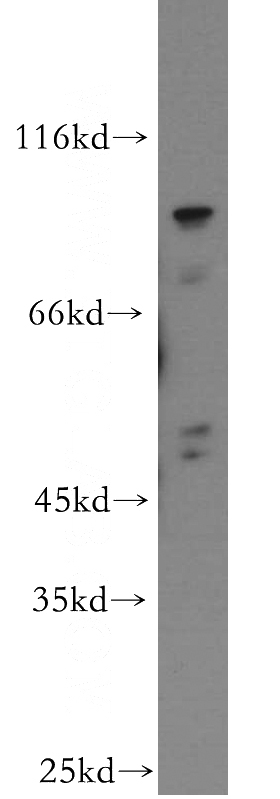 HeLa cells were subjected to SDS PAGE followed by western blot with Catalog No:116861(WDR24 antibody) at dilution of 1:500