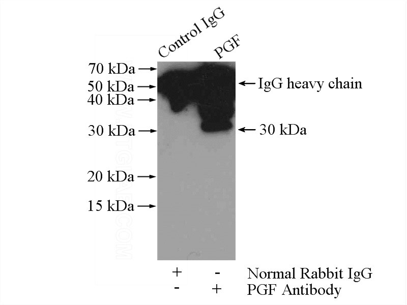 IP Result of anti-PGF (IP:Catalog No:113892, 4ug; Detection:Catalog No:113892 1:500) with human placenta tissue lysate 4400ug.