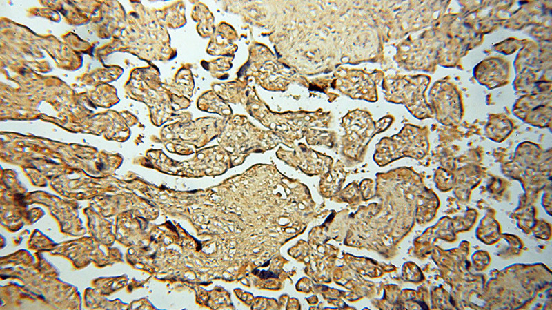 Immunohistochemical of paraffin-embedded human placenta using Catalog No:109295(CHST14 antibody) at dilution of 1:50 (under 10x lens)