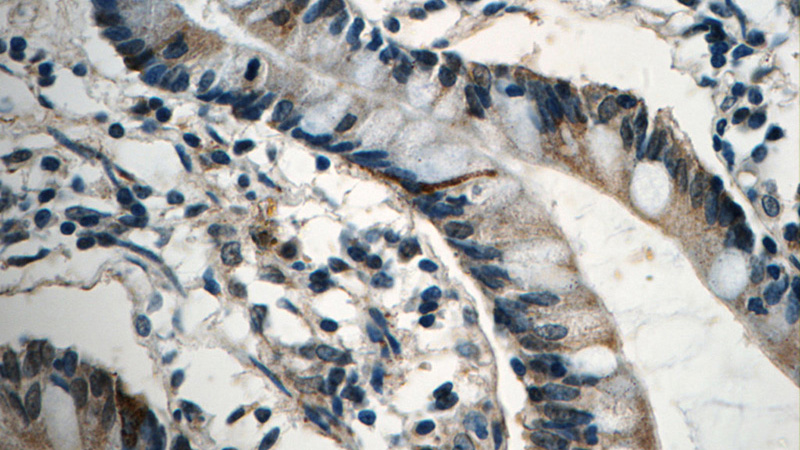 Immunohistochemistry of paraffin-embedded human small intestine tissue slide using Catalog No:110082(DNAH6 Antibody) at dilution of 1:50 (under 40x lens)
