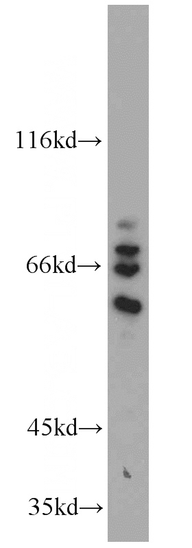 human placenta tissue were subjected to SDS PAGE followed by western blot with Catalog No:109183(CEP63 antibody) at dilution of 1:800