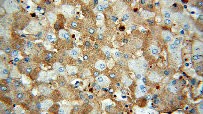 Immunohistochemical of paraffin-embedded human liver using Catalog No:112002(KIF18A antibody) at dilution of 1:100 (under 40x lens)
