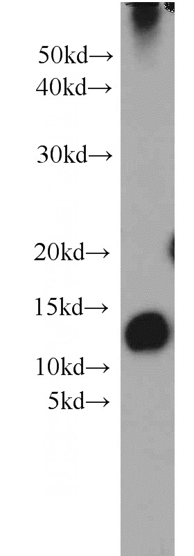 human placenta tissue were subjected to SDS PAGE followed by western blot with Catalog No:115186(SH3BGRL2 antibody) at dilution of 1:1000