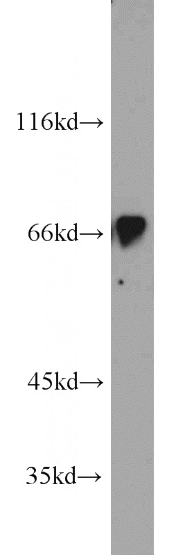 mouse kidney tissue were subjected to SDS PAGE followed by western blot with Catalog No:111672(IFT81 antibody) at dilution of 1:500
