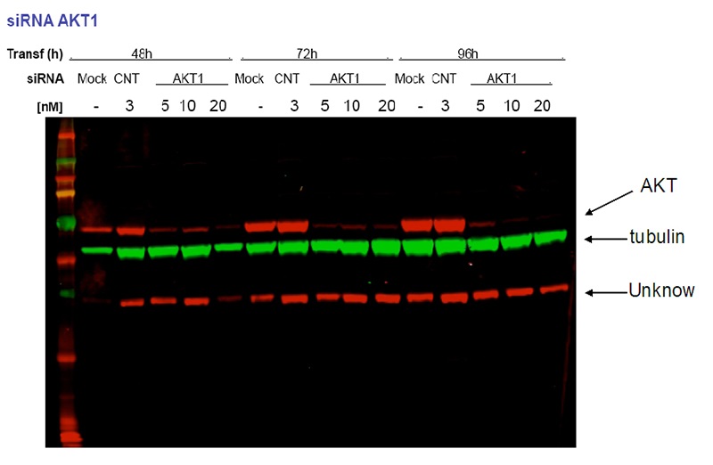 siRNA AKT1 result from Dr. Eva Martinez-Balibrea. Green:tubulin, Red:Catalog No:107948, AKT1.
