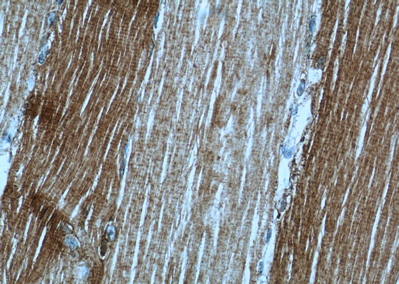 Immunohistochemistry of paraffin-embedded human skeletal muscle tissue slide using Catalog No:112103(KLHL31 Antibody) at dilution of 1:50 (under 40x lens)