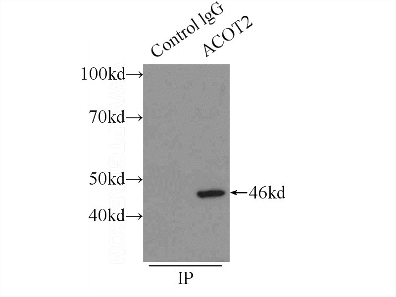 IP Result of anti-ACOT2 (IP:Catalog No:107745, 3ug; Detection:Catalog No:107745 1:500) with HepG2 cells lysate 1700ug.