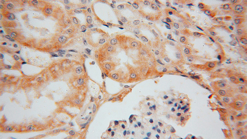 Immunohistochemical of paraffin-embedded human kidney using Catalog No:113351(OPA3 antibody) at dilution of 1:50 (under 40x lens)