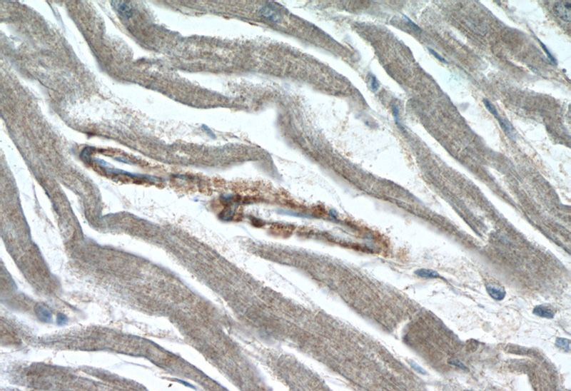 Immunohistochemistry of paraffin-embedded human heart slide using Catalog No:117046(ZFYVE19 Antibody) at dilution of 1:50