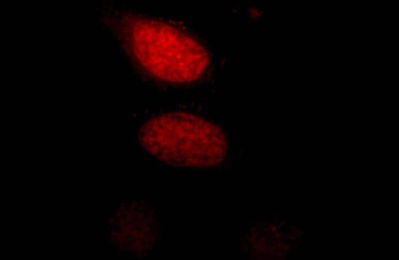 Immunofluorescent analysis of Hela cells, using LEO1 antibody Catalog No:112196 at 1:25 dilution and Rhodamine-labeled goat anti-rabbit IgG (red).