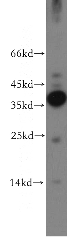 human brain tissue were subjected to SDS PAGE followed by western blot with Catalog No:114720(RLBP1L2 antibody) at dilution of 1:500
