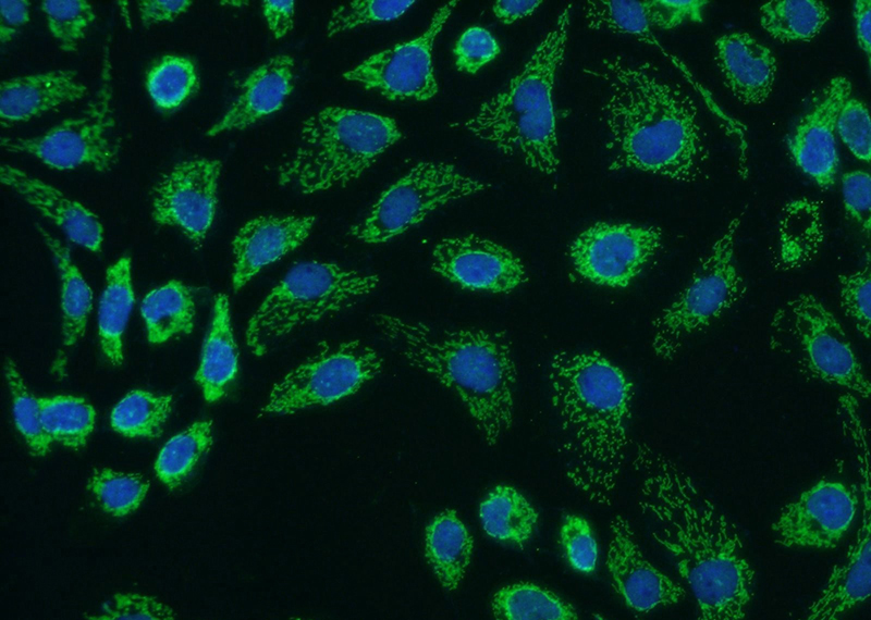 Immunofluorescent analysis of A431 cells using Catalog No:116846(WBP11 Antibody) at dilution of 1:25 and Alexa Fluor 488-congugated AffiniPure Goat Anti-Rabbit IgG(H+L)