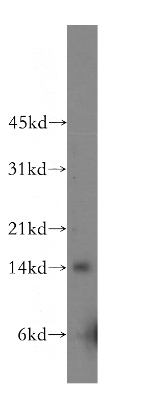 human colon tissue were subjected to SDS PAGE followed by western blot with Catalog No:110836(LGALS2 antibody) at dilution of 1:300