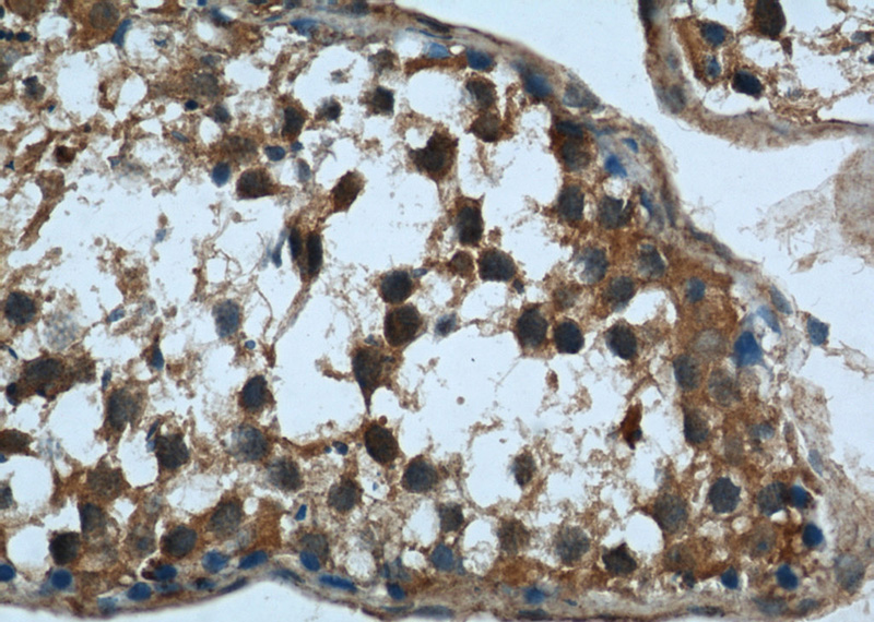 Immunohistochemical of paraffin-embedded human testis using Catalog No:114867(KIAA0226 antibody) at dilution of 1:50 (under 40x lens)