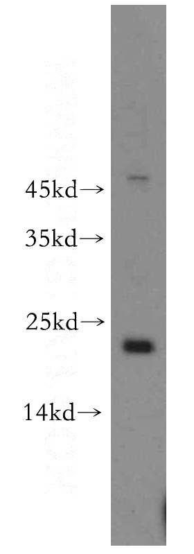 HeLa cells were subjected to SDS PAGE followed by western blot with Catalog No:114037(POLR1D antibody) at dilution of 1:500
