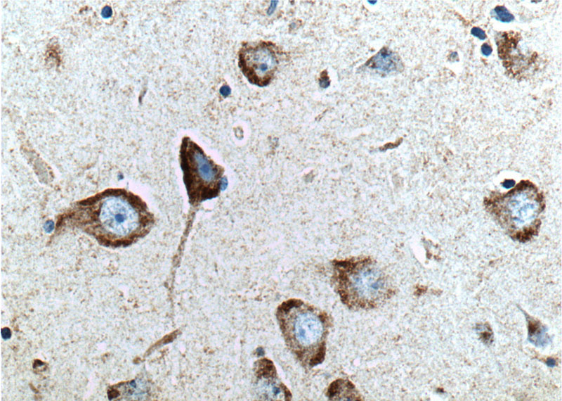 Immunohistochemistry of paraffin-embedded human brain tissue slide using Catalog No:114454(RAB5A-Specific Antibody) at dilution of 1:200 (under 40x lens).