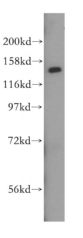 NIH/3T3 cells were subjected to SDS PAGE followed by western blot with Catalog No:111390(HDLBP antibody) at dilution of 1:500