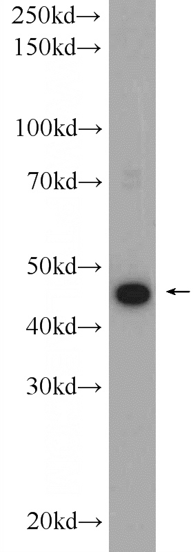 rat kidney tissue were subjected to SDS PAGE followed by western blot with Catalog No:116831(WISP1 Antibody) at dilution of 1:600