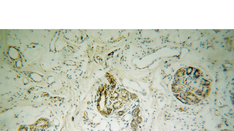Immunohistochemical of paraffin-embedded human skin using Catalog No:109757(DCT antibody) at dilution of 1:100 (under 10x lens)