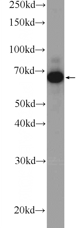 A431 cells were subjected to SDS PAGE followed by western blot with Catalog No:114011(PLS3 Antibody) at dilution of 1:600