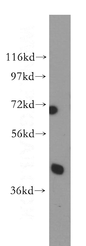 HeLa cells were subjected to SDS PAGE followed by western blot with Catalog No:113685(PCBP2 antibody) at dilution of 1:1000