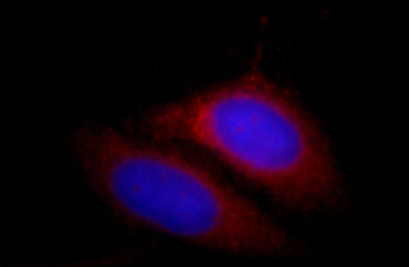 Immunofluorescent analysis of HepG2 cells, using CDK5RAP3 antibody Catalog No:109164 at 1:25 dilution and Rhodamine-labeled goat anti-rabbit IgG (red).Blue pseudocolor = DAPI (fluorescent DNA dye).