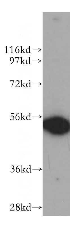 K-562 cells were subjected to SDS PAGE followed by western blot with Catalog No:109842(P54 antibody) at dilution of 1:500