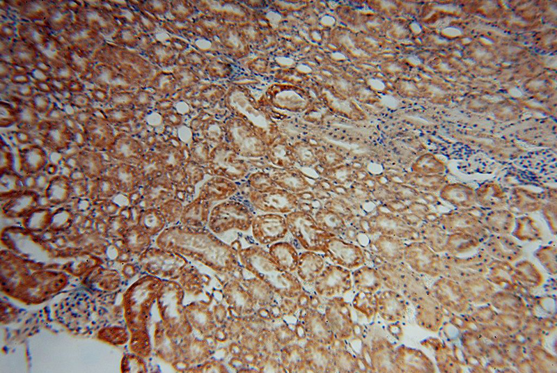 Immunohistochemical of paraffin-embedded human kidney using Catalog No:115022(SCUBE3 antibody) at dilution of 1:50 (under 10x lens)