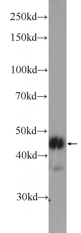 HEK-293 cells were subjected to SDS PAGE followed by western blot with Catalog No:111017(GKAP1 Antibody) at dilution of 1:600