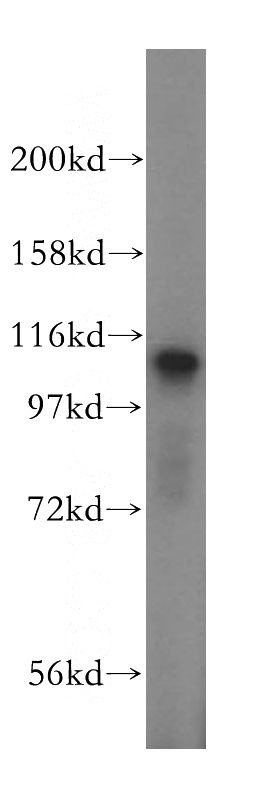 mouse liver tissue were subjected to SDS PAGE followed by western blot with Catalog No:116370(TSR1 antibody) at dilution of 1:500