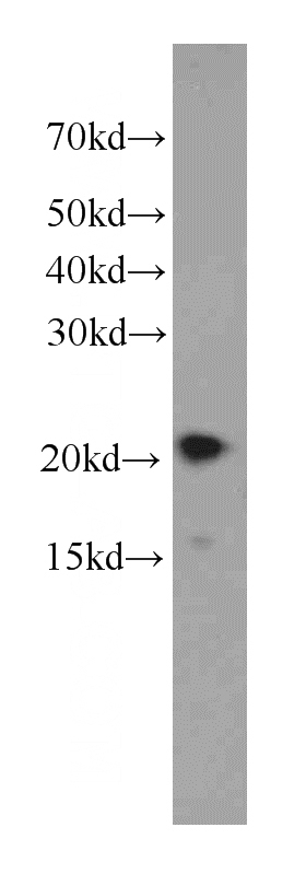 human brain tissue were subjected to SDS PAGE followed by western blot with Catalog No:107323(NCALD antibody) at dilution of 1:1000